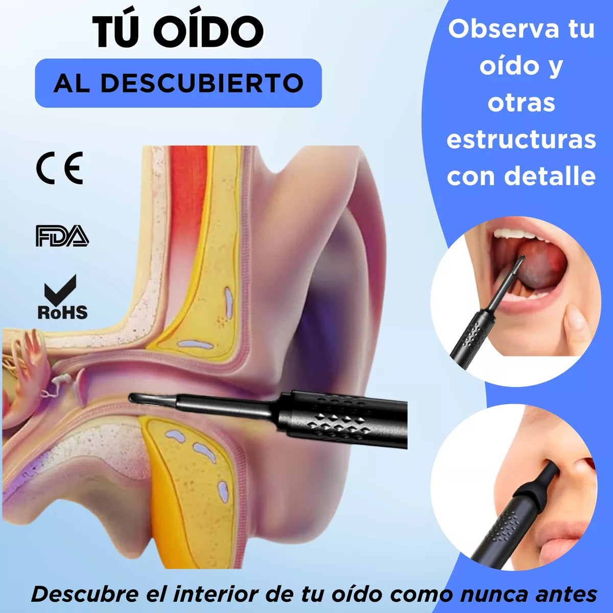 Removedor de Cerumen con Cámara HD